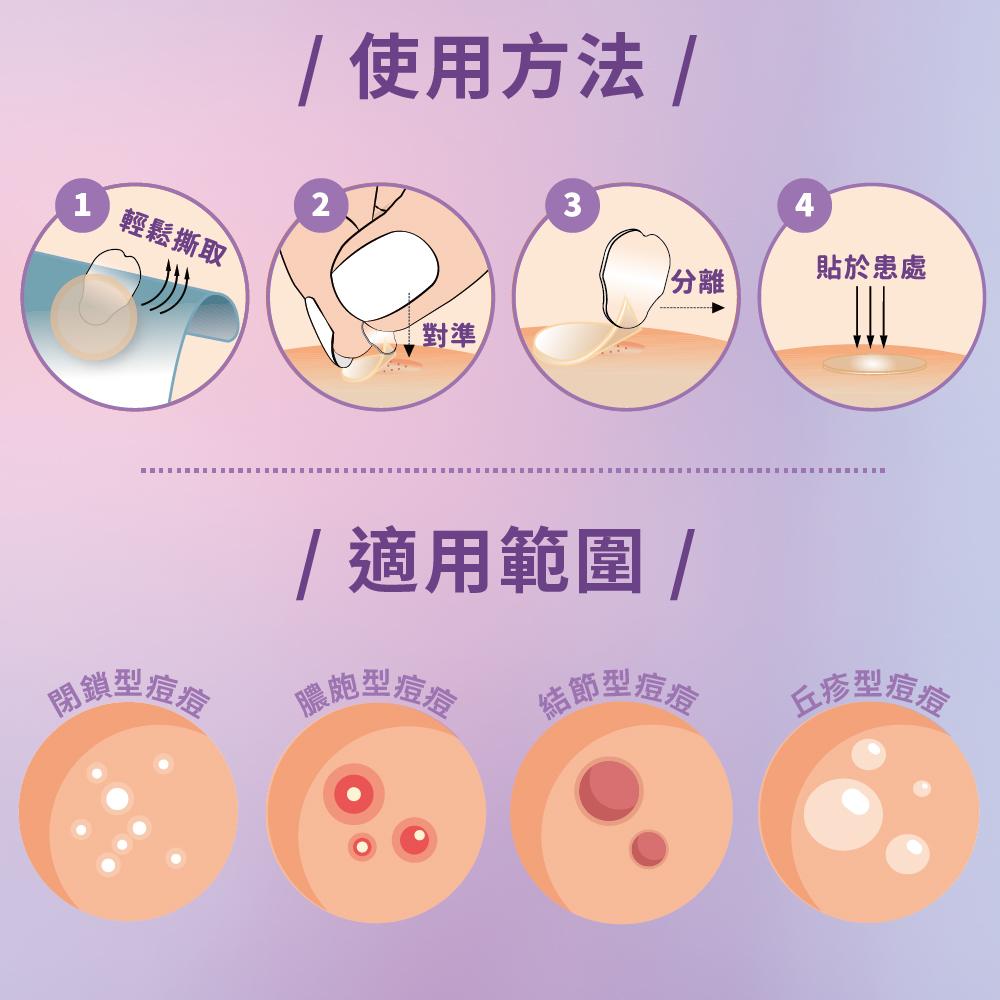 親水性敷料 易撕痘痘貼(滅菌)
